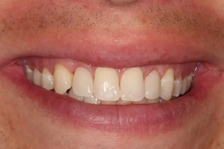 after cosmetic dentistry results by Brad Gorsky, DMD, PC