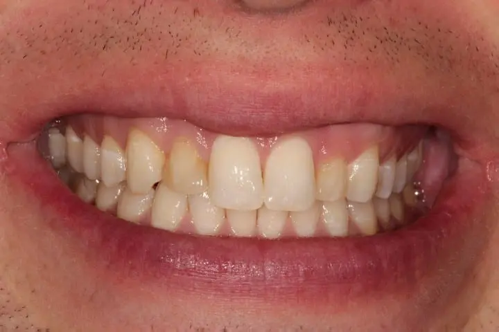 before cosmetic dentistry by Brad Gorsky, DMD, PC