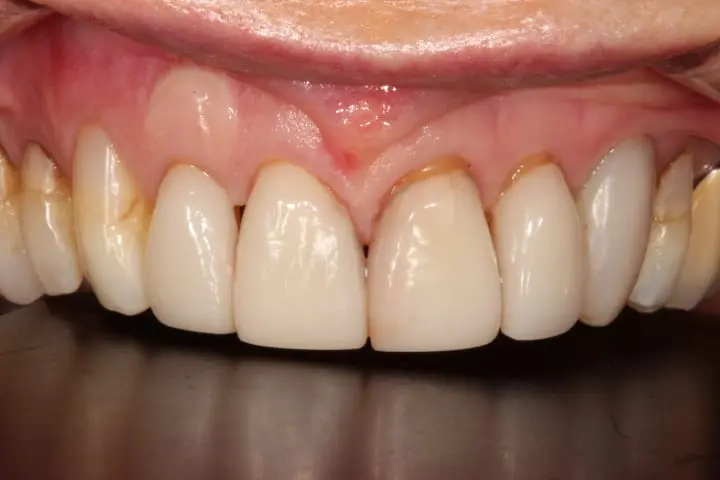 before cosmetic dentistry by Brad Gorsky, DMD, PC