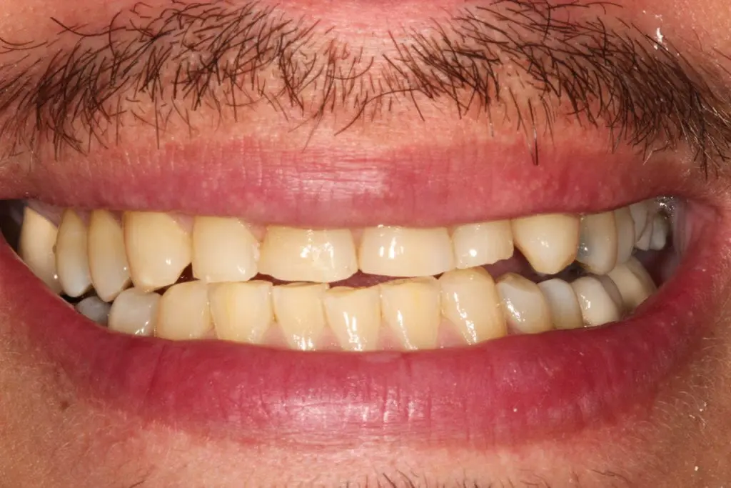 before cosmetic dentistry by Brad Gorsky, DMD, PC