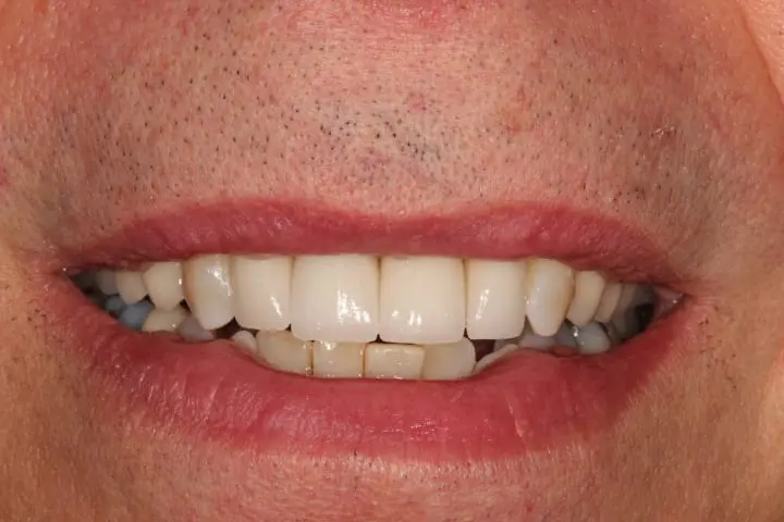 after cosmetic dentistry results by Brad Gorsky, DMD, PC