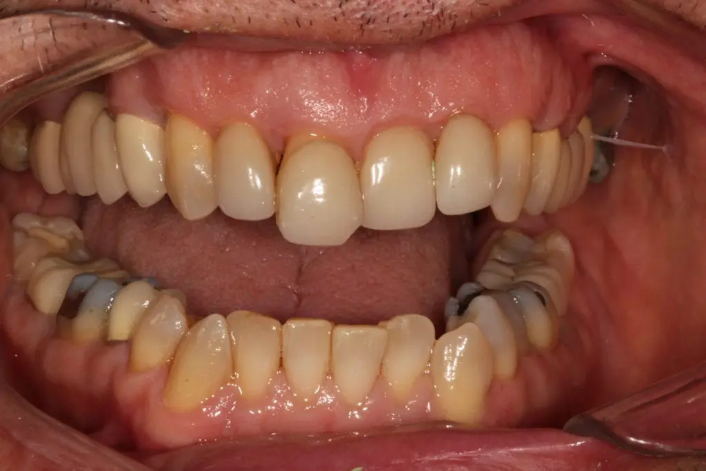 before cosmetic dentistry by Brad Gorsky, DMD, PC