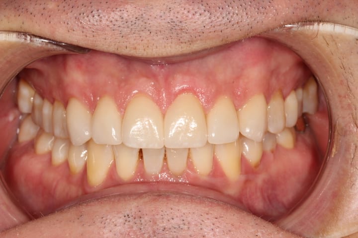 after cosmetic dentistry results by Brad Gorsky, DMD, PC
